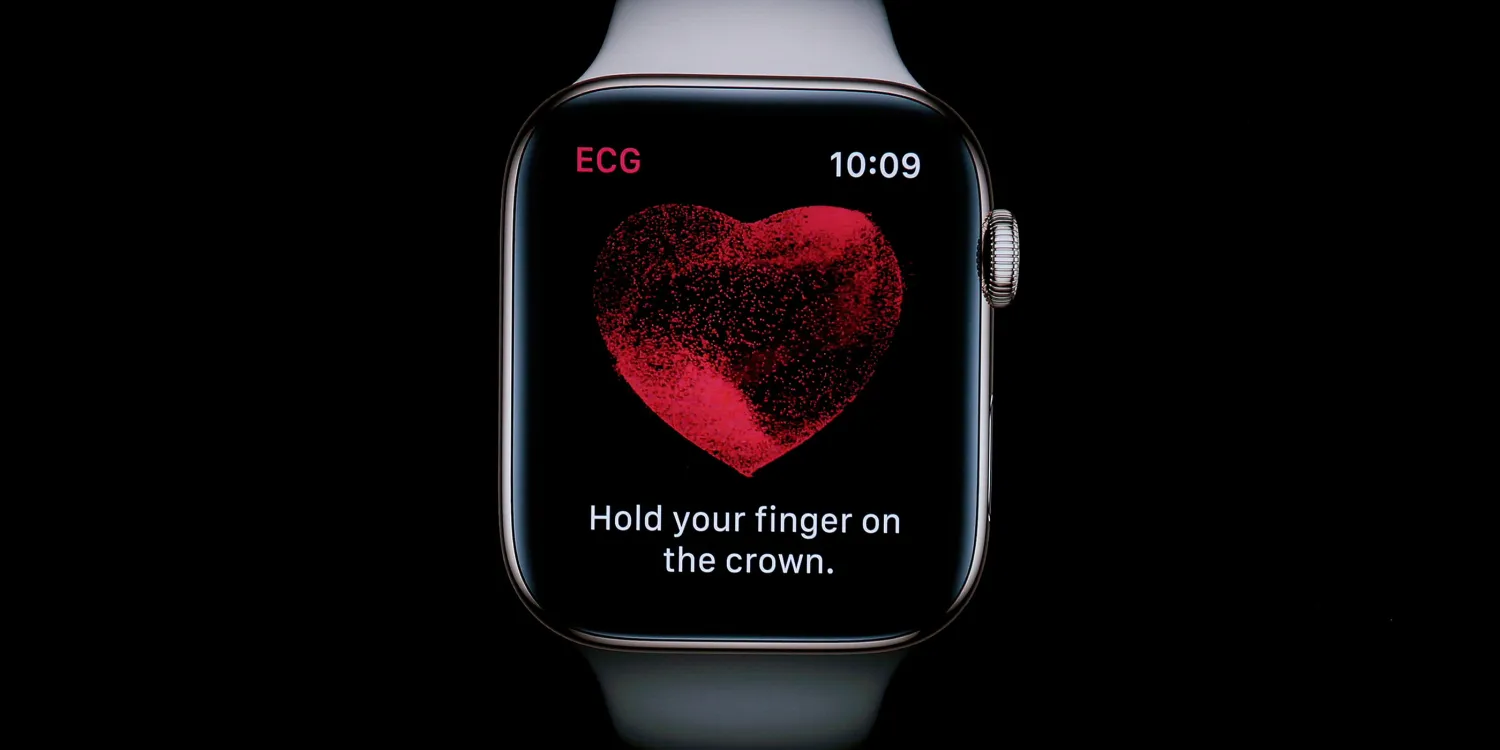Apple Watch can help spot another life-threatening heart condition, Mayo Clinic study reveals